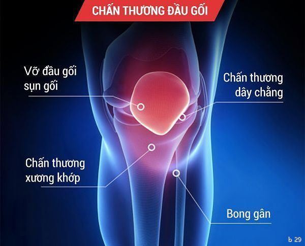 Bảo vệ đầu gối khỏi những tổn thương trong quá trình thi đấu